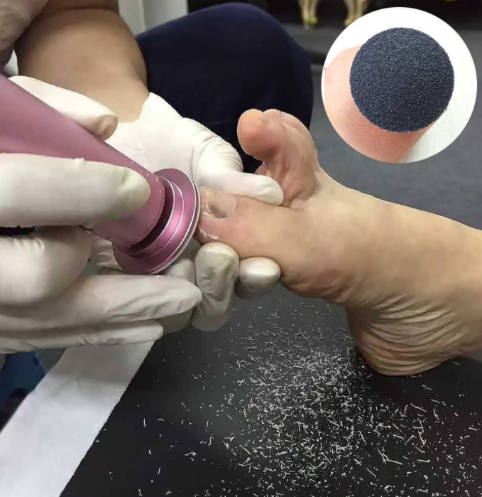 Rechargeable Sawing File For Feet Dead Skin Callus Peel Remover