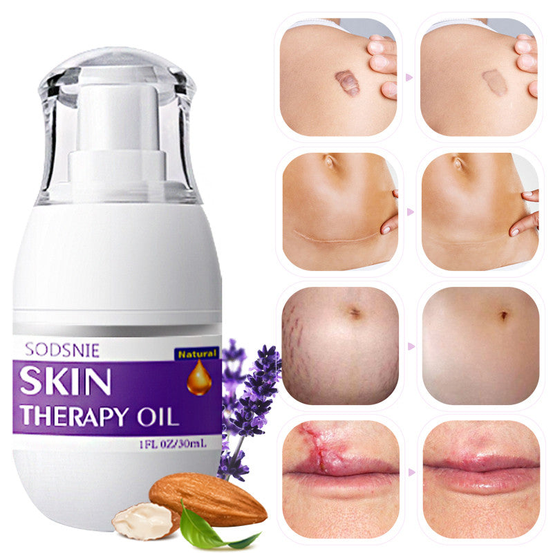Skin Treatment Oil Remove Puncture Cellulite Stretch Mark
